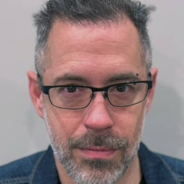 Patient after hair restoration