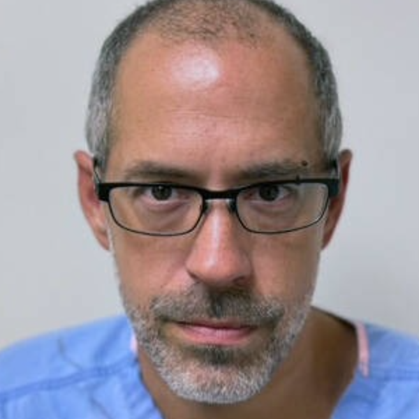 Patient before hair restoration