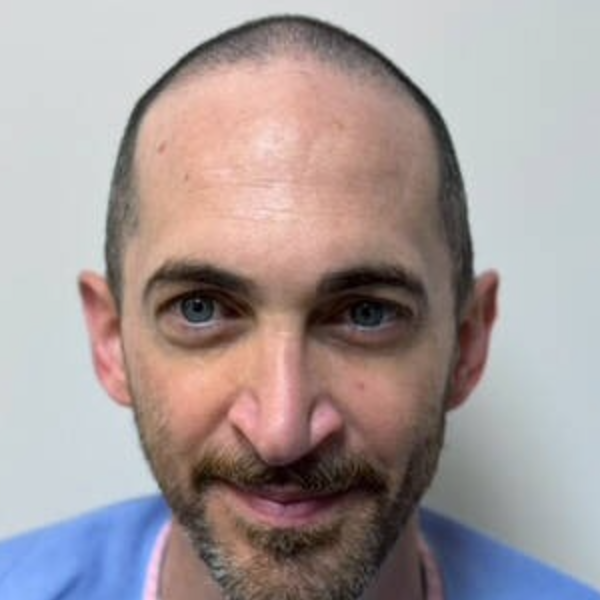 Patient before hair restoration